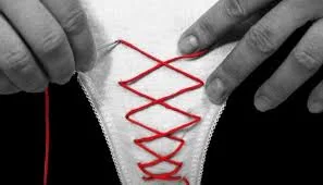 هل التخدير كلي أم موضعي؟ | Hymenoplasty illustrative image